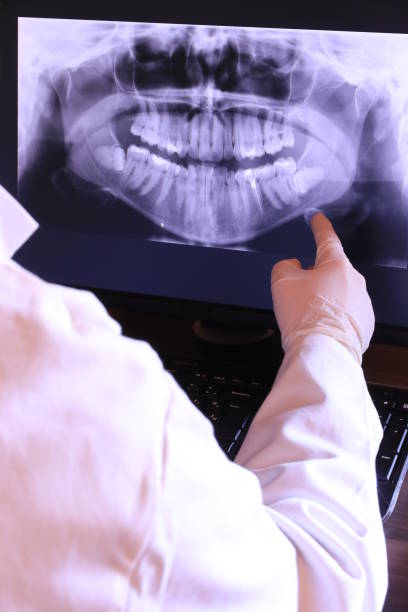 Best Emergency Wisdom Teeth Removal in Williamson, AZ